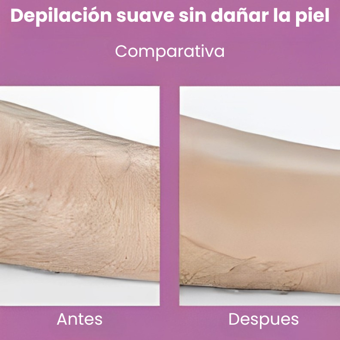 Depiladora de Cristal MagicTouch®